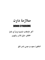 متلازمة داون